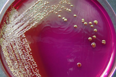 cultivo de bacterias